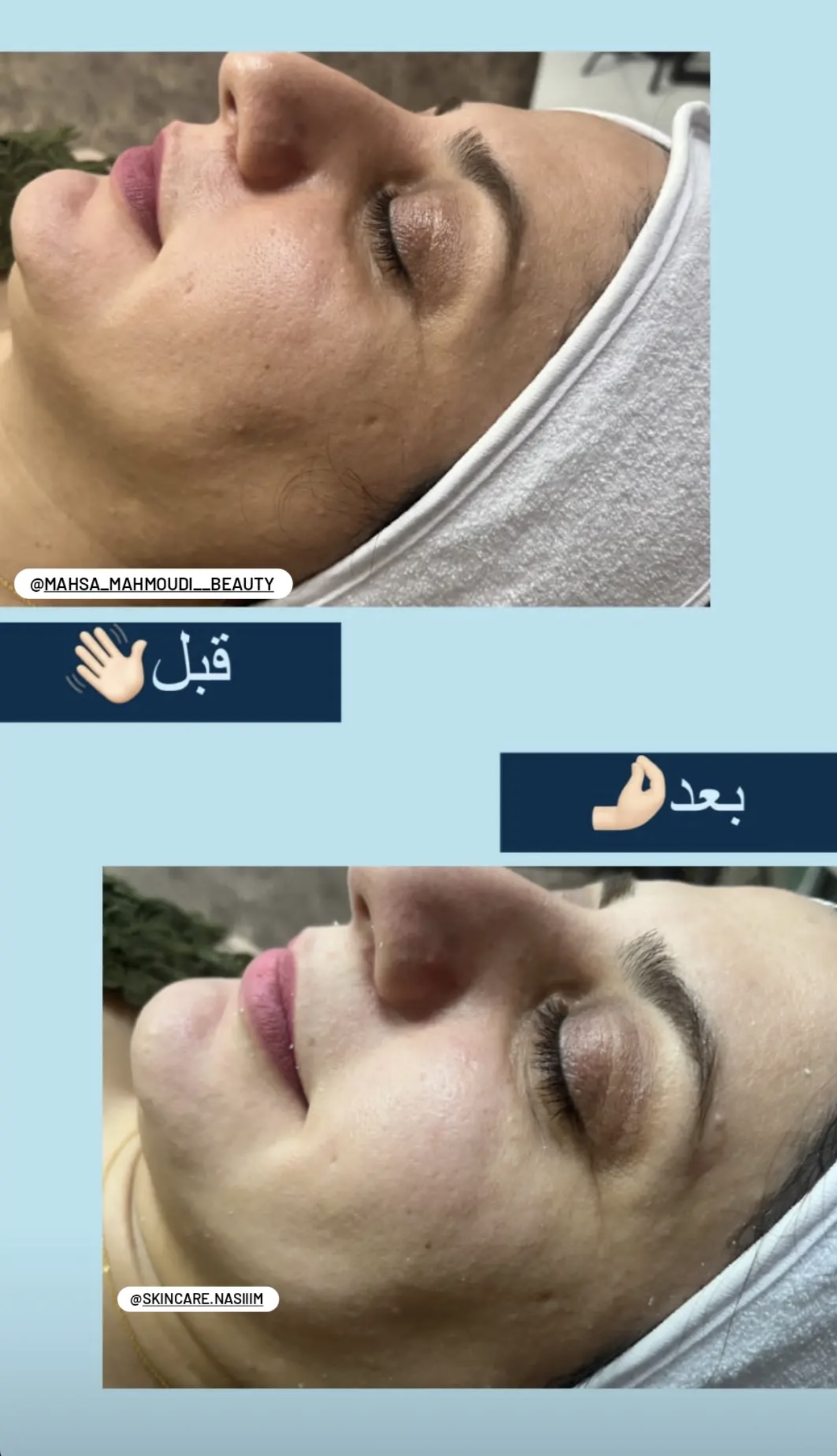 زیبایی مهسا محمودی — پاکسازی پوست