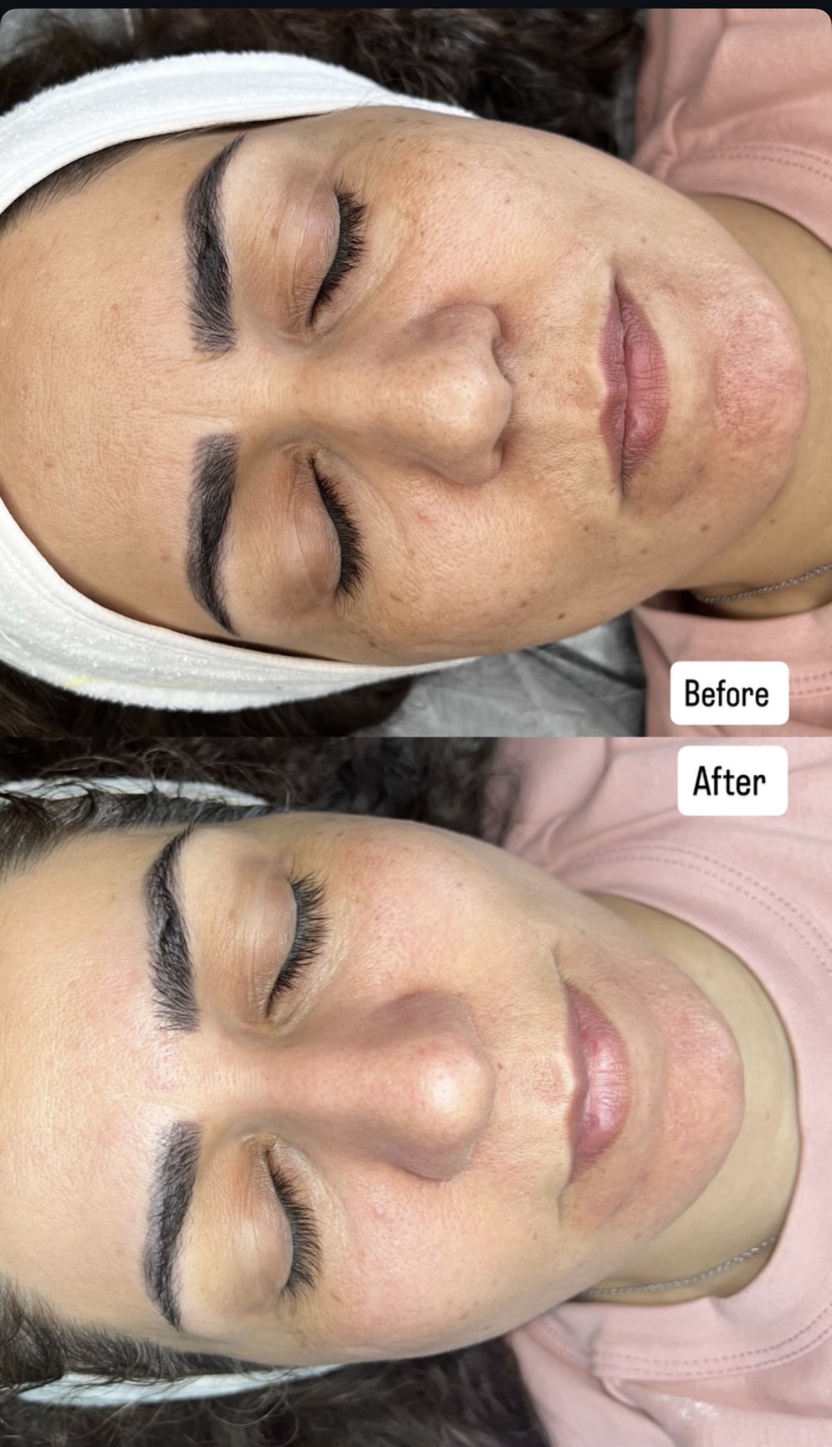 فیشیال تخصصی