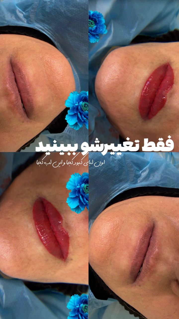 شیدینگ لب