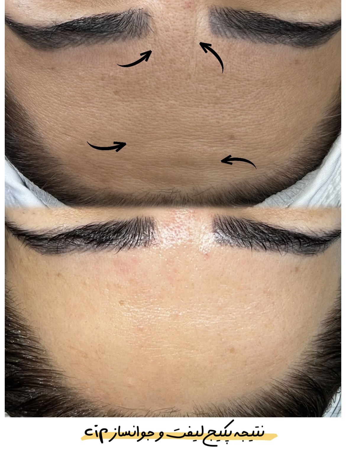 فیشیال تخصصی