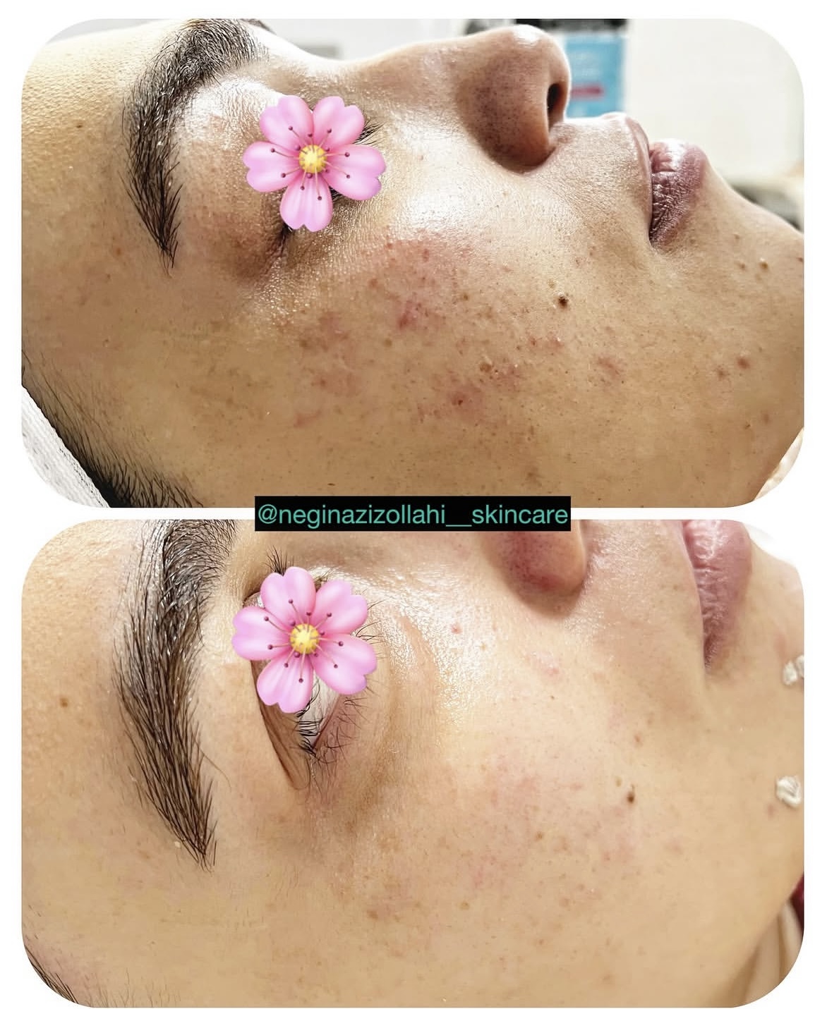 فیشیال تخصصی