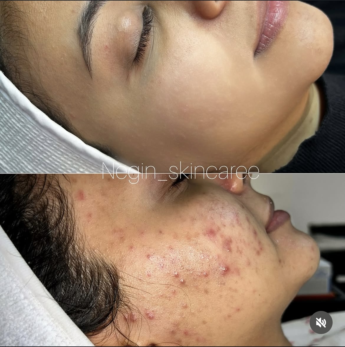فیشیال تخصصی