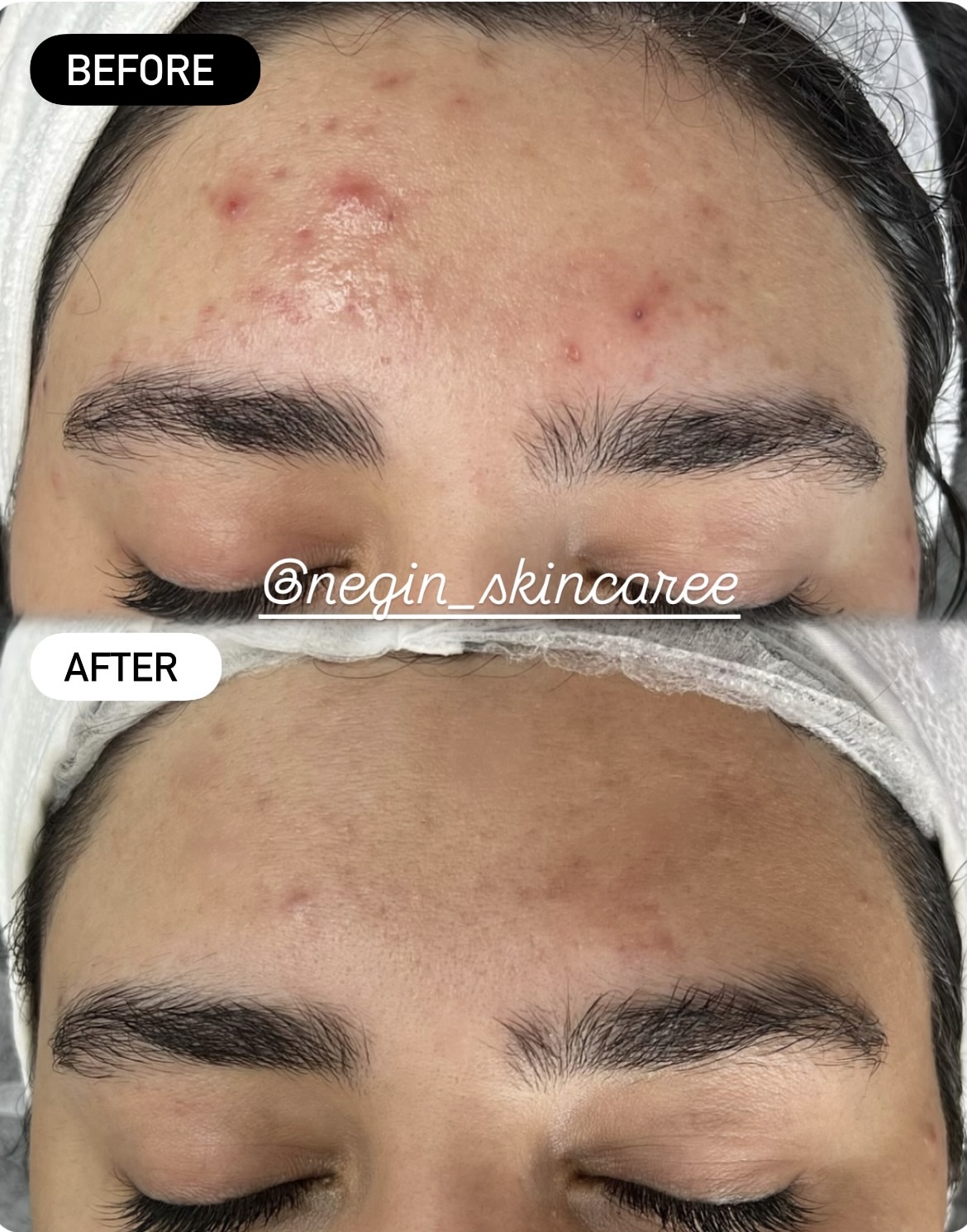 فیشیال تخصصی