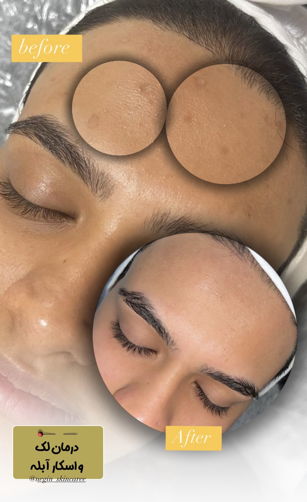 فیشیال تخصصی